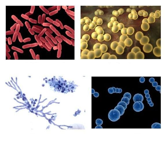 Pathogens of pathological secretions